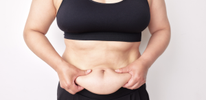 Full Tummy Tuck Best Prices Near Alexandria VA